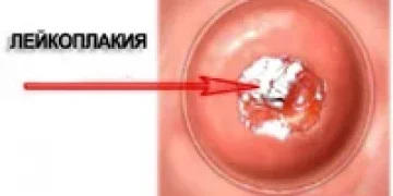 Магнитотерапия в гинекологии - цены в Москве